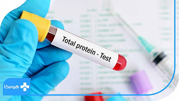Protein در آزمایش خون