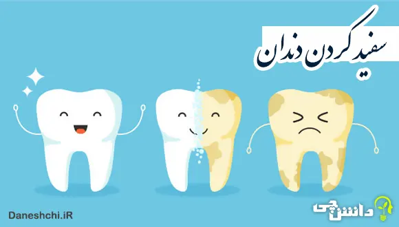چطور دندان هایمان را سفید کنیم؟