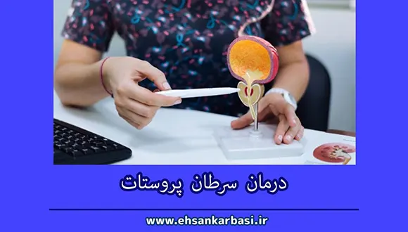 پیشرفت های نوین در درمان سرطان پروستات + 3 درمان پیشرفته و جدیدتر