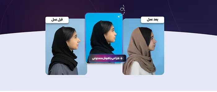 جراحی بینی با هوش مصنوعی 

