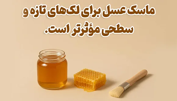 ماسک عسل برای لکه صورت