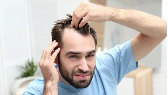 علل رایج ریزش مو
