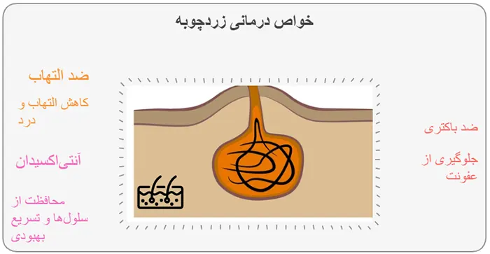 زردچوبه برای کیست مویی