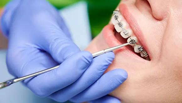 ارتودنسی دندان شرق تهران