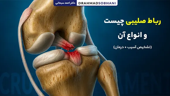 رباط صلیبی چیست و انواع آن