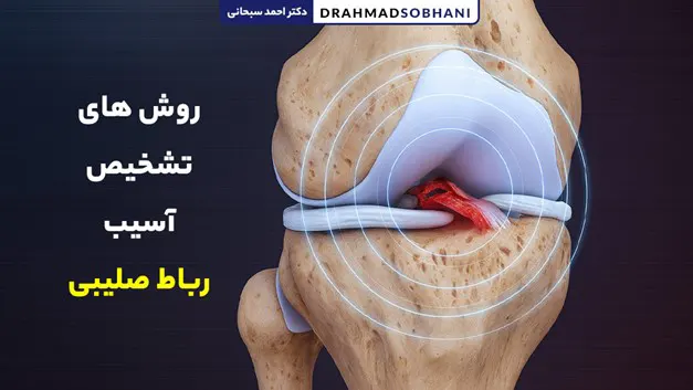 روش های تشخیص آسیب رباط صلیبی