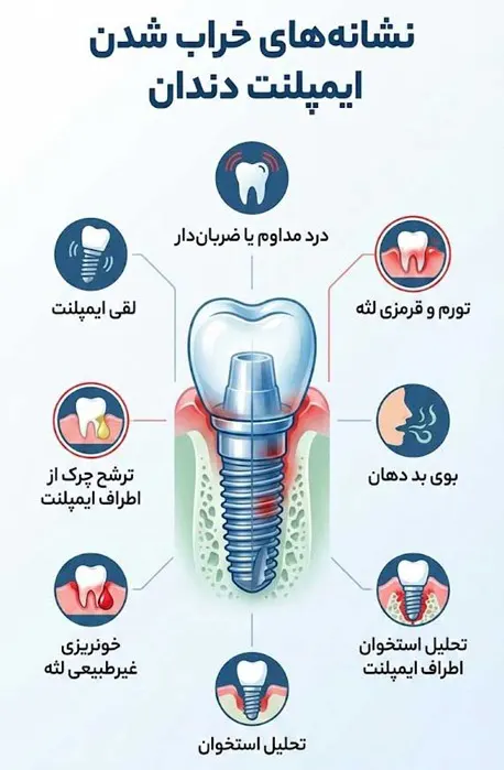 نشانه هاب خراب شدن ایمپلنت