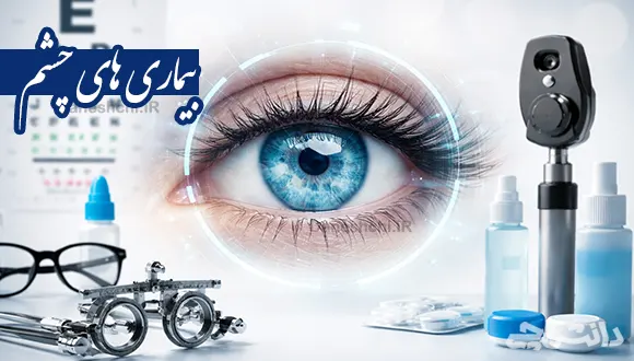 تحقیق در مورد بیماری های چشم