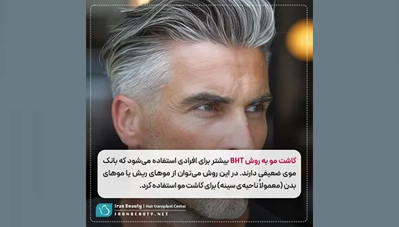 کاشت مو به روش BHT چیست