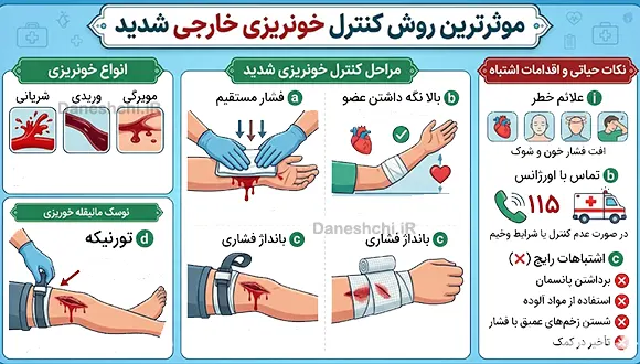 روش کنترل خونریزی خارجی شدید