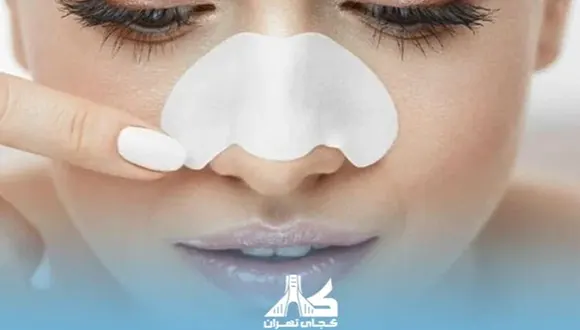 تا چند روز بعد عمل بینی باید سربالا باشد؟