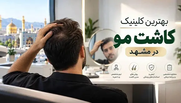 10 مورد از بهترین کلینیک های کاشت مو در مشهد