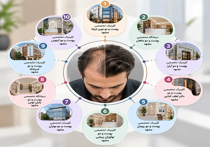 آشنایی با مراکز کاشت مو در مشهد